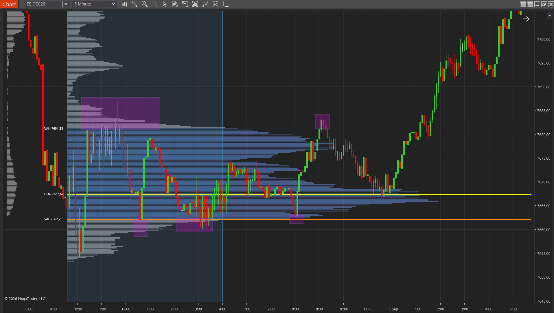 Kaizen Volume Profile on an ES chart with the point of control, value area high and value area low labeled