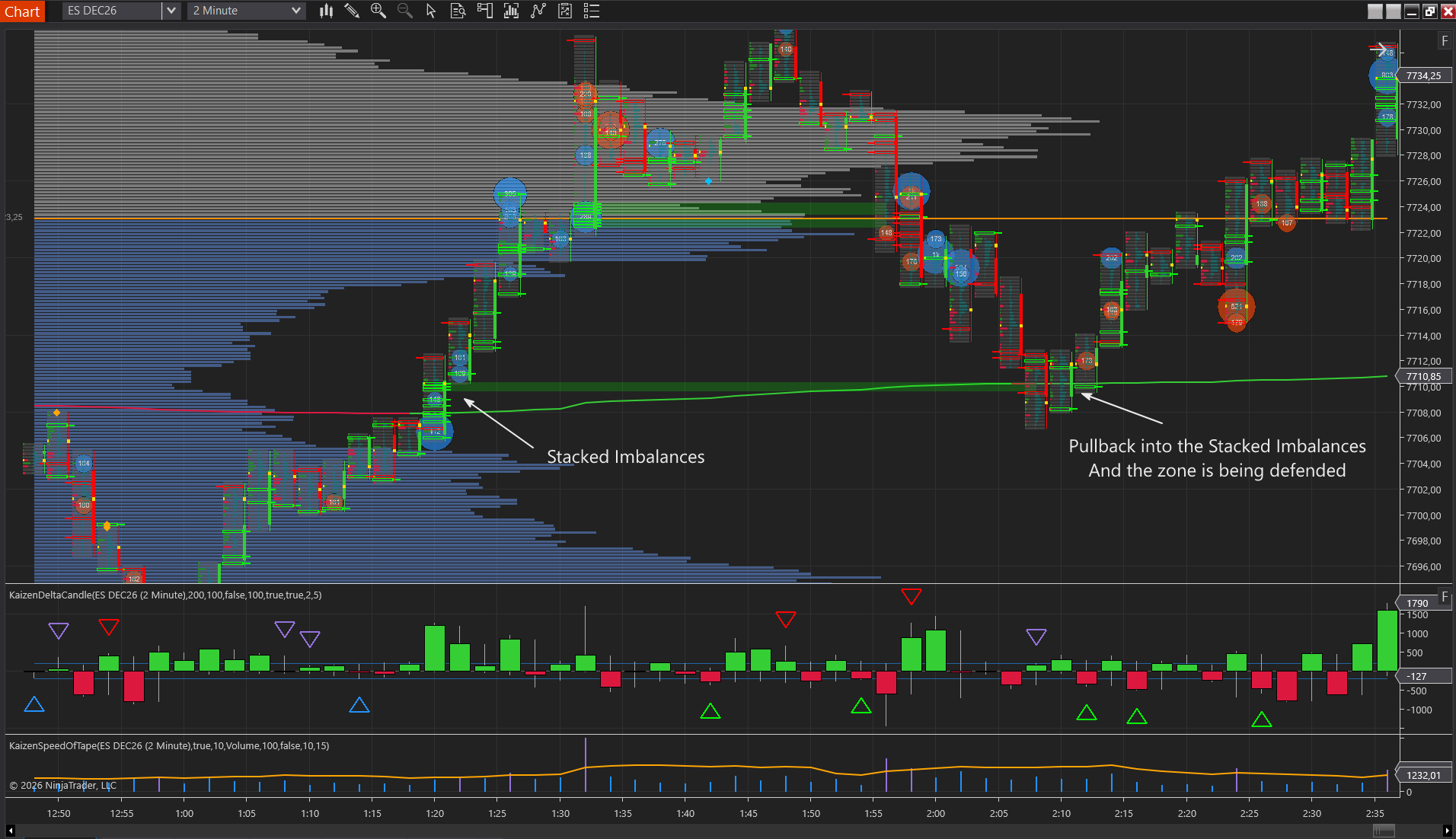 Kaizen Footprint with a stacked buying imbalance marked as price breaks out of a level on an ES chart